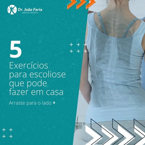 5 Exercícios para escoliose que pode fazer em casa