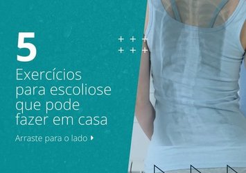 5 Exercícios para escoliose que pode fazer em casa