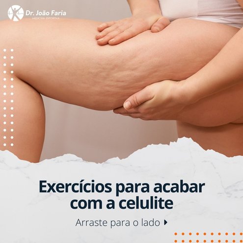 Exercícios para acabar com a celulite