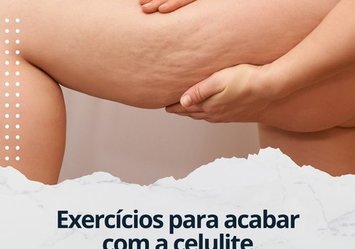 Exercícios para acabar com a celulite