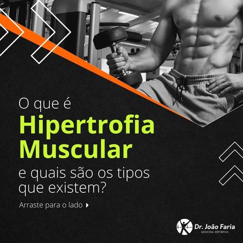 O que é hipertrofia Muscular e quais são os tipos que existem?