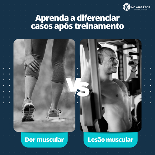 Aprenda a diferenciar casos após treinamento: Dor Muscular VS Lesão Muscular