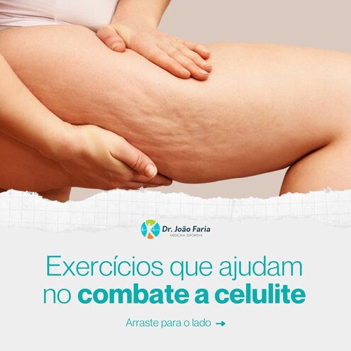 Exercícios que ajudam no combate a celulite