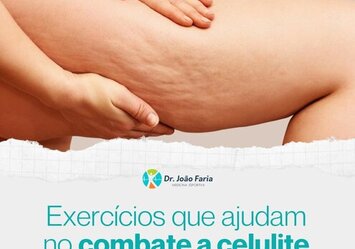 Exercícios que ajudam no combate a celulite