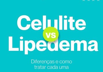 Celulite vs Lipedema - Diferenças e como tratar cada uma