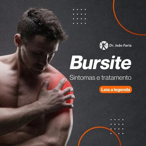 Bursite - Sintomas e tratamento