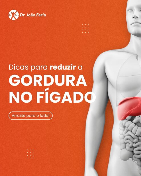 Dicas para reduzir a gordura no fígado